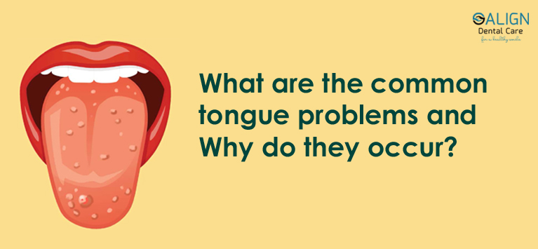 Tongue Disorders | Tongue Problems