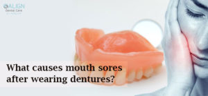 What causes mouth sores after wearing dentures?