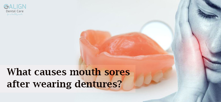 What Causes Mouth Sores After Wearing Dentures 